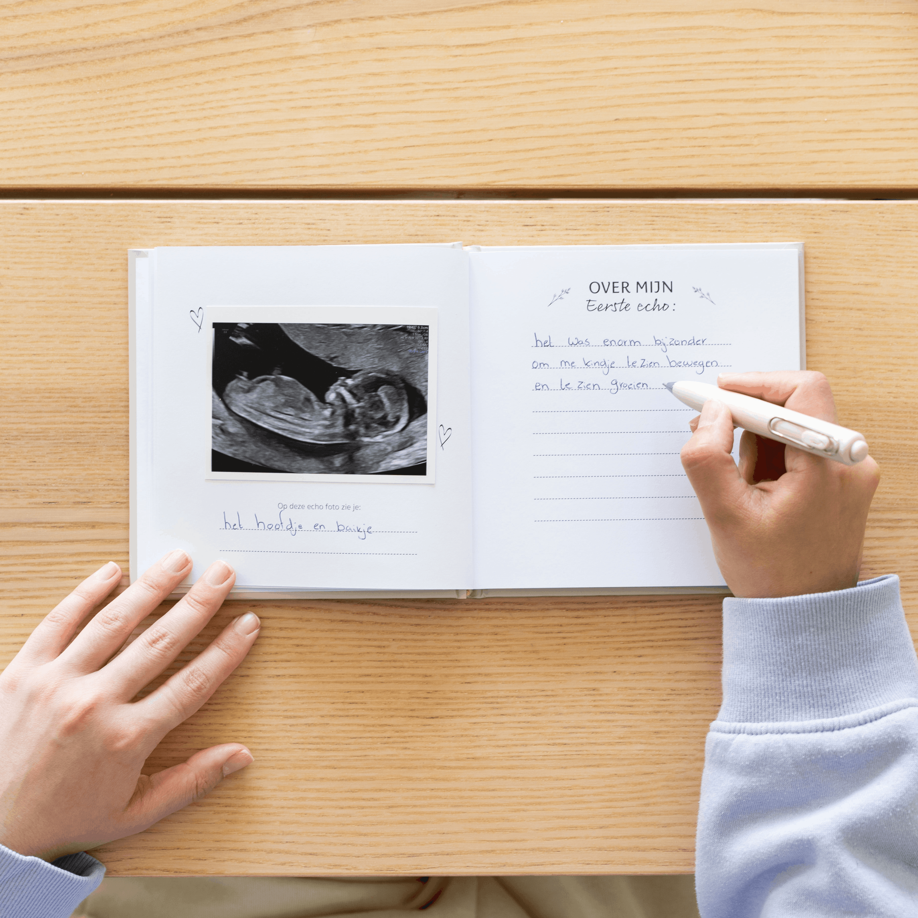 Sonogram Booklet - My Most Beautiful Sonograms