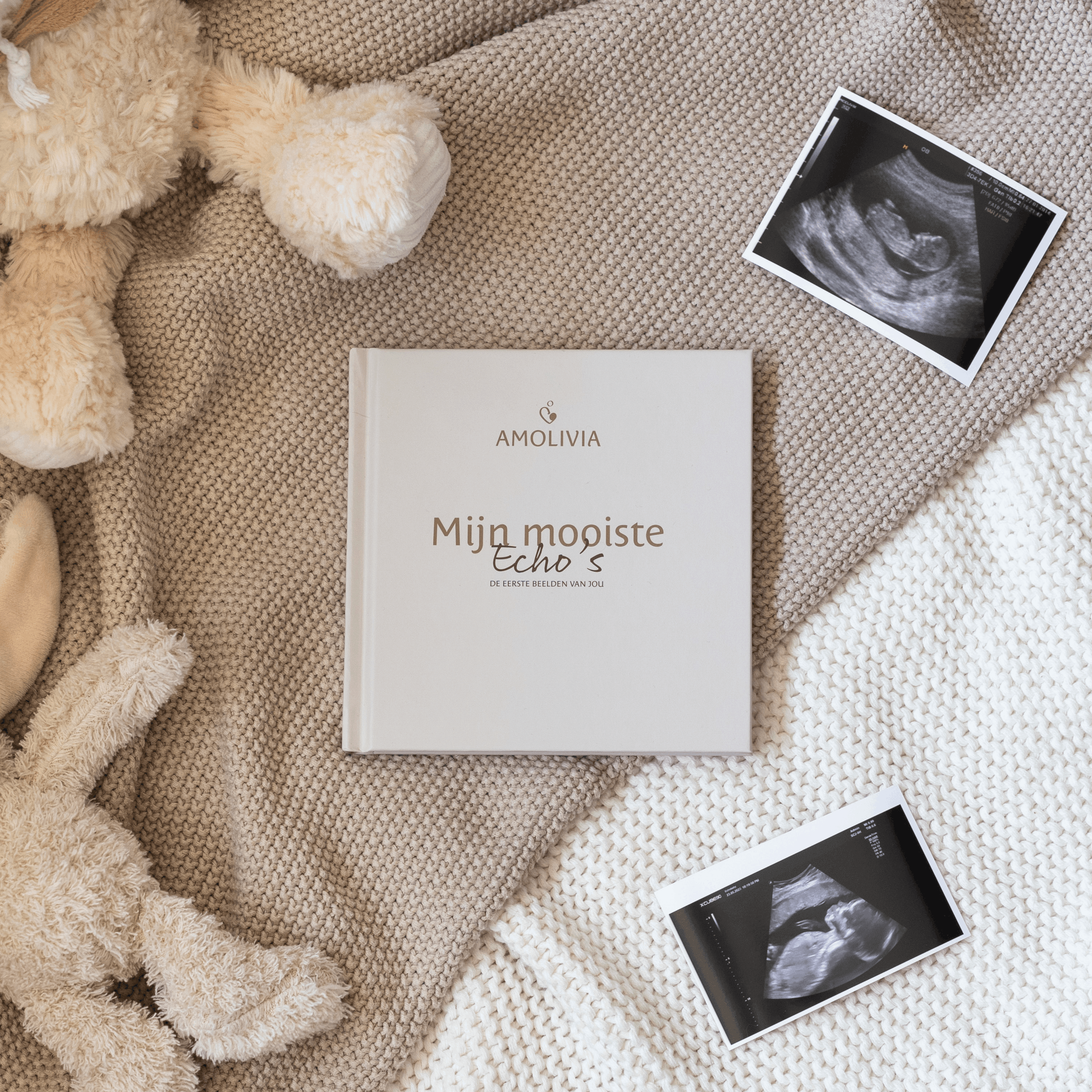 Sonogram Booklet - My Most Beautiful Sonograms